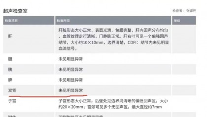爱康国宾CEO曾揭行业造假黑幕：护士代替医生做超声检查，抽血后直接倒掉