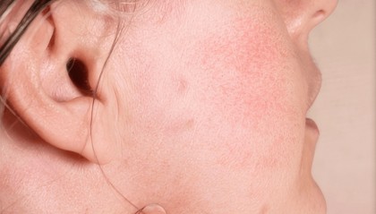 西班牙“莱后”自用精华油，才人民币 200 多？