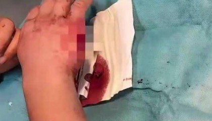 手部外伤被要求检查前列腺？网友吐槽宜兴一医院不合理检查，多方回应