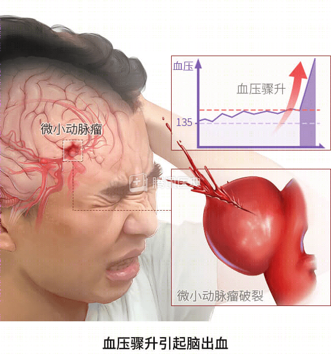 百万粉丝网红“云南阿奎”抢救8天后离世，“留下4个年幼的孩子”