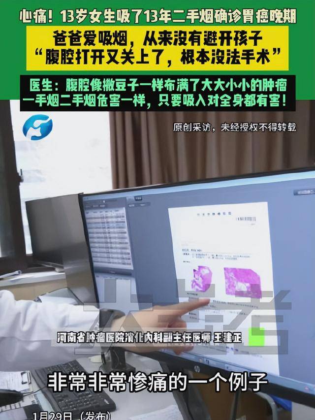 爸爸常年在家吸烟,13岁女儿吸13年二手烟腹腔内长满肿瘤